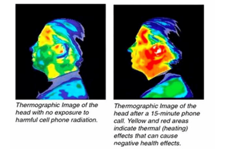 Electromagnetic Radiation – The Dark side of Technology